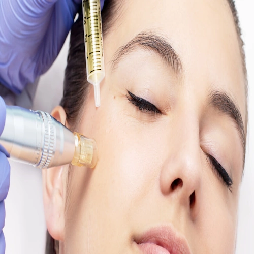 Mesotherapy